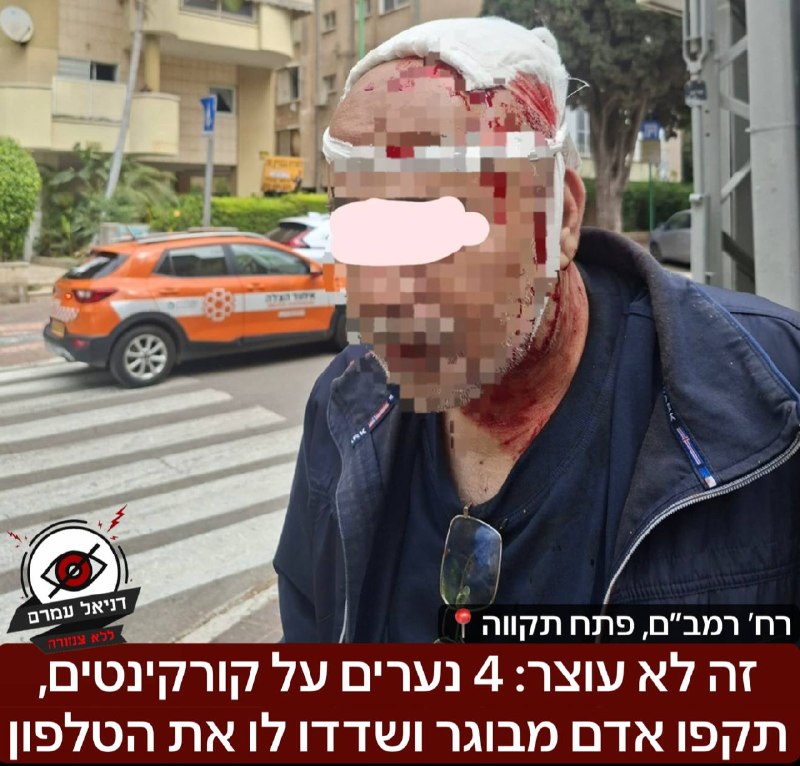 4 נערים על קורקינטים תקפו אדם מבוגר ושדדו את הטלפון שלו בפתח תקווה