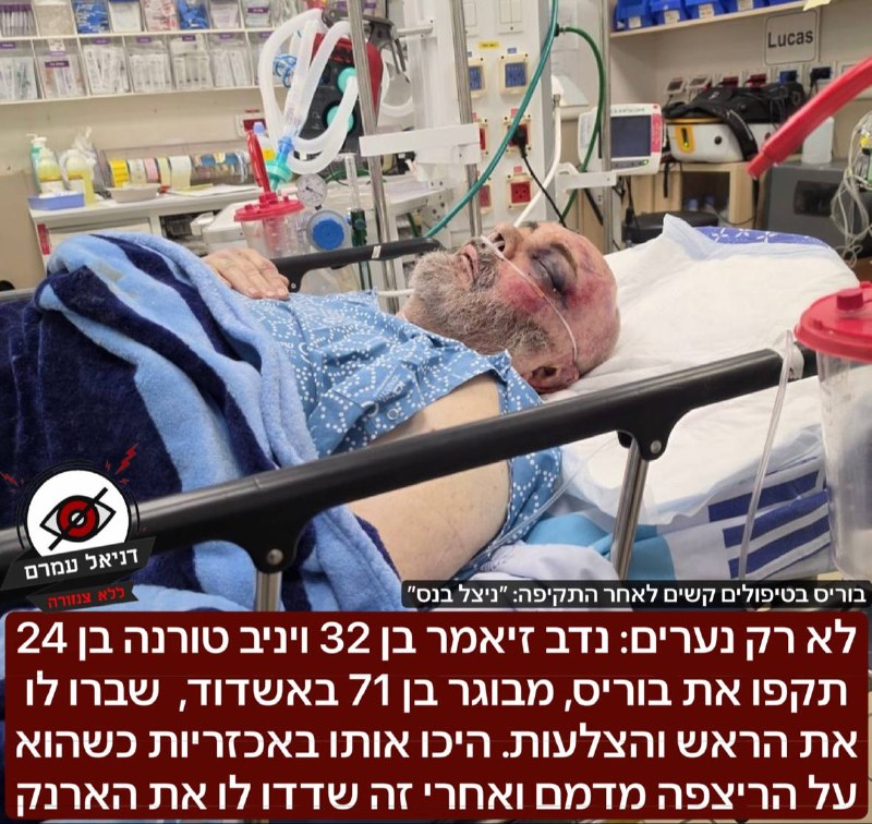 שוד אכזרי באשדוד: קשיש בן 71 הותקף, הוכה שבורחתו ושדד
