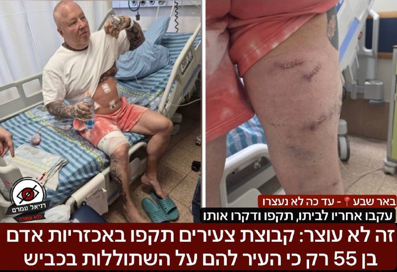 תקיפת חזיתית בבאר שבע: צעירים תקפו קשיש בן 78 אל מול אימו