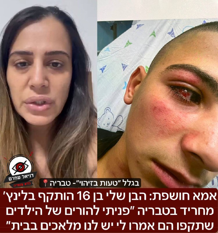 אמא חושפת: הבן שלי הותקף בלינץ' מחריד בטבריה ״פניתי להורים של הילדים הם אמרו לי יש לנו מלאכים בבית״