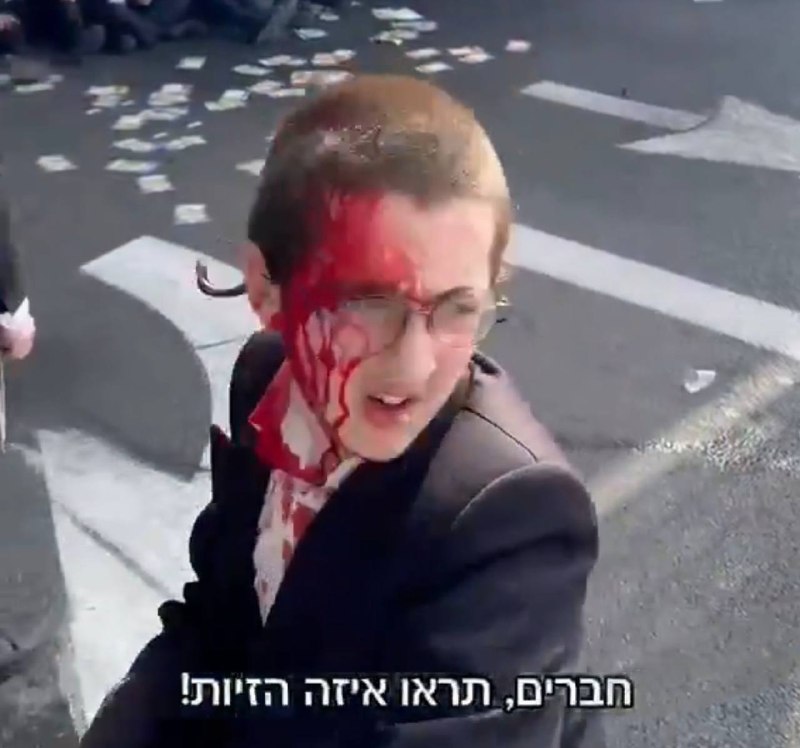השוטרים מאבדים את זה בהפגנות החרדים: ״כל הרגליים שלו מגואלות בדם״- נער עם פרצוף מלא בדם ואדם שכל המכנס שלו קרוע כתוצאה מאלימות השוטרים: המשטרה מגיבה ״זו הפגנה בלתי חוקית מפעילים כוח סביר״. ואוו מחריד.
