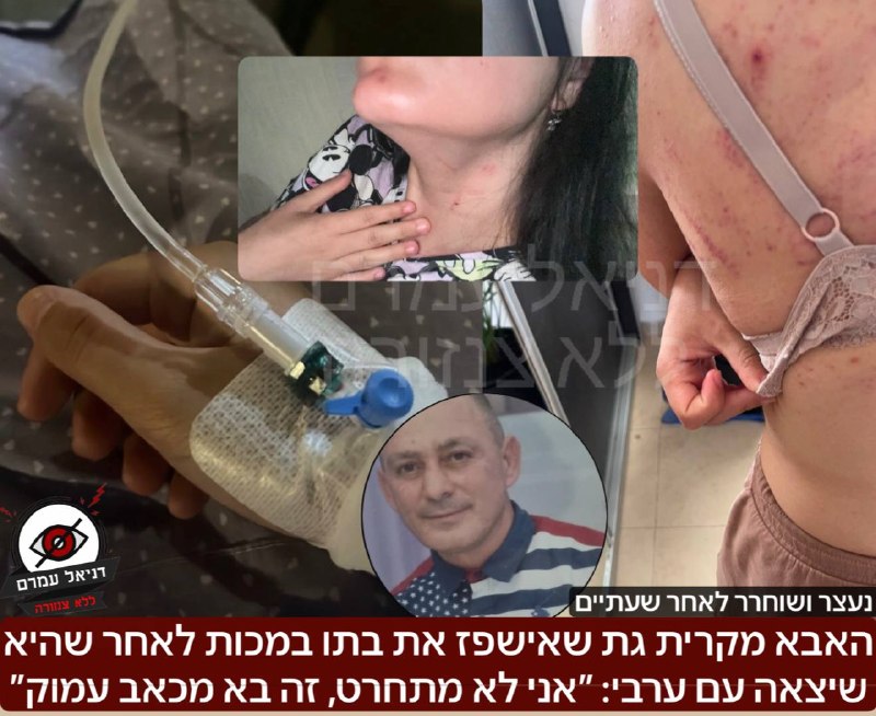 האבא מקרית גת שאישפז את הבת שלו לאחר שיצאה עם ערבי: ״אני לא מתחרט, זה בא מכאב עמוק״: בשישי חשפנו כאן לראשונה בדניאל עמרם על צעירה בת 20 מהקריות שהותקפה באלימות פיזית קשה והובהלה לבית חולים לאחר שאביה 