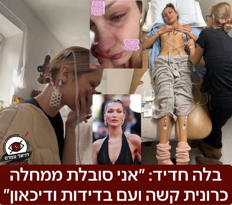 בלה חדיד חושפת: "אני סובלת ממחלה כרונית קשה, בדידות ודיכאון"