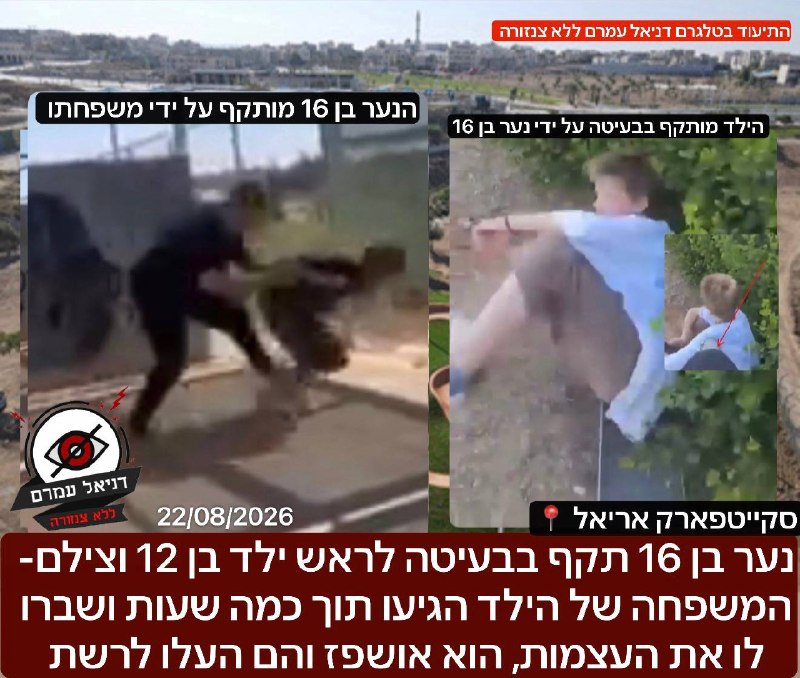 התיעוד: נער בן 16 תקף בבעיטה לראש ילד בן 12 באריאל - צילם והעלה לרשת- המשפחה של הילד הגיעו תוך כמה שעות ושברו לו את העצמות, הוא אושפז והם העלו לרשת: האירוע התרחש במהלך השבת בסקייטפארק באריאל, התיעודים