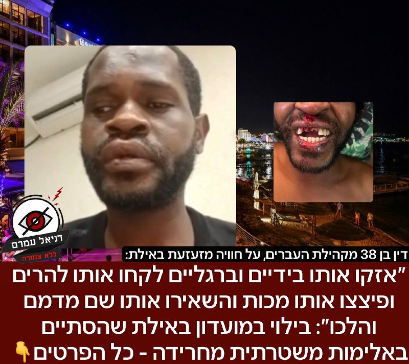 ״אפילו לא עצרו אותו- אזקו אותו בידיים וברגליים לקחו אותו להרים ופיצצו אותו מכות והשאירו אותו שם מדמם והלכו״: בילוי במועדון באילת שהסתיים באלימות משטרתית מחרידה: ידין, בן 38 מקהילת העברים יצא ביום שישי